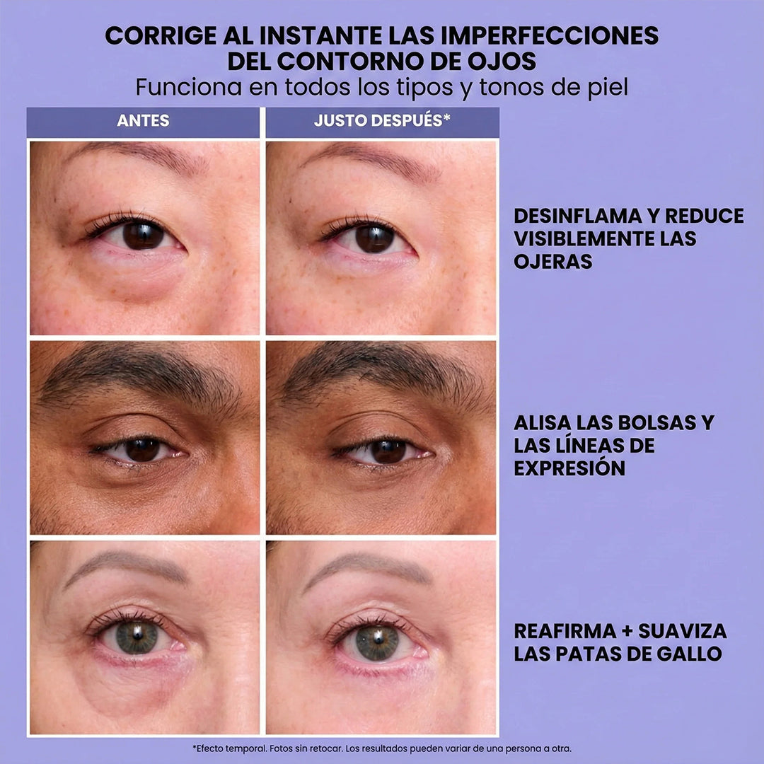 Selyn-eye™ Anti-Ojeras INSTANTÁNEO