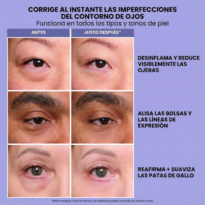 Selyn-eye™ Anti-Ojeras INSTANTÁNEO
