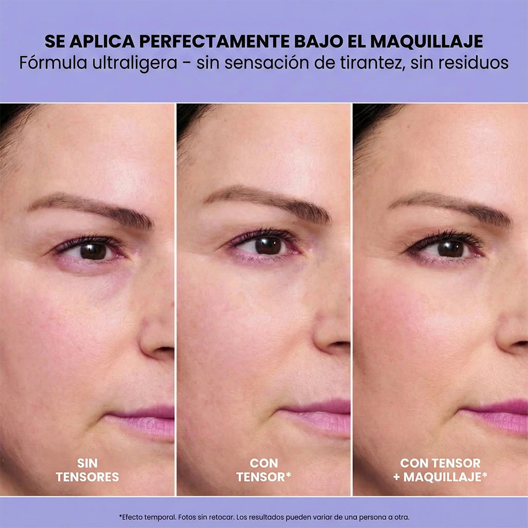 Selyn-eye™ Anti-Ojeras INSTANTÁNEO